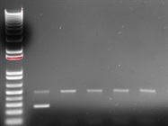 Running 1% Agarose Gel