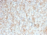 Protein Microarray Specificity-Validated Monoclonal Antibodies from NSJBIO