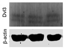 Dvl3 Antibody that Works, but Not Very Well