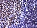 Excellent Differentiation of Mouse and Human Tissue by IHC