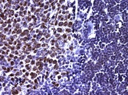 Excellent Differentiation of Mouse and Human Tissue by IHC