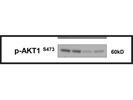 Great Antibody to Detect mTORC2 Activity Via pAKT