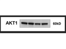 Great Monoclonal Antibody to Detect AKT1 Isoform