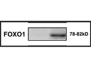 Great Antibody to Detect Total FoxO1 Protein