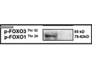 Reliable Antibody to Detect p-FoxO1/3 Activity