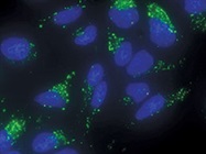 Simplify Autophagy Detection: No Transfection Needed