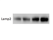 Great Western Antibody to Detect Lysomsomes via LAMP2