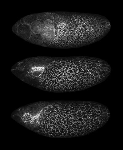 confocal