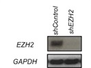 Good EZH2 Antibody for Western Blot
