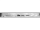 Useful Antibody for Western Blot for Detecting Exosomes