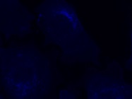 Sensitive Reagent for Detection of Cellular Cholesterol Levels
