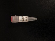 High Fidelity DNA Polymerase Compared to the Conventional Taq Polymerase