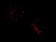 Staining Specific to GM1 of Cell Membrane