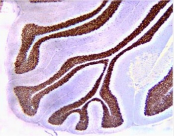ihc