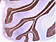 Top Five Tips for Neuroscience ICC and IHC