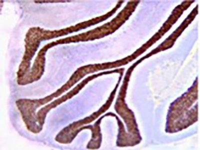  Top Five Tips for Neuroscience ICC and IHC