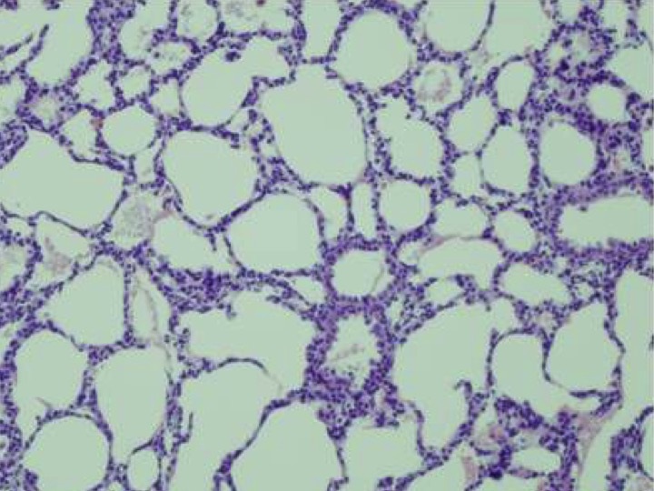 Mouse Lung Stained with Hematoxylin and Eosin Stain Kit | Biocompare ...