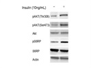 Phospho-S6 Ribosomal Protein Antibody for Western Blot