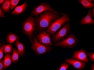 Multiplex Microscopy with Alexa Fluor® 594 Conjugated Antibodies