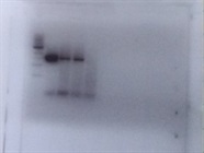 Used To Clone 86 Genes, Zero Errors Detected By Sequencing