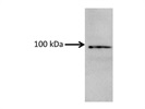 DPP9/DPRP2 Antibody For Western Blot