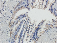 Mlkl antibody