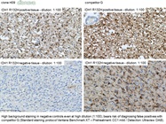 10% off Dianova’s IDH1 R132H Antibody