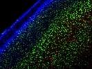 Excellent Immunostaining of Cortical Neurons