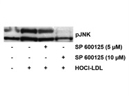 SP 600125 Inhibits JNK Activation in HOCl-LDL Treated Cardiomyocytes