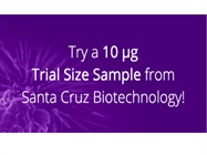 Try a Santa Cruz Biotechnology (SCBT) Monoclonal Antibody Sample.
