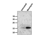 Western Blot of HeLa Cell Histone Proteins Treated with Phospho-Histone H2A.X (Ser139) Antibody