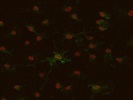 Best Antibody for Human Antigen R Detection