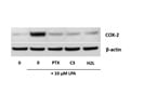 Pertussis Toxin Inhibits LPA Induced COX-2 Expression in Osteosarcoma Cells
