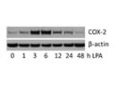 LPA Induces COX-2 Expression in MG-63 Cells