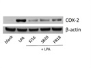 FR 180204 Blocks LPA Induced COX-2 Expression