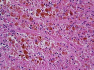 Sample Preparation for FFPE Immunohistochemistry