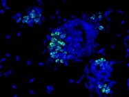 Ki-67 Antibody for Immunofluorescence