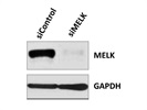 Anti-MELK Antibody