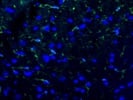 Great Antibody for P2RY12 Immunofluorescence