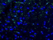 Great Antibody for P2RY12 Immunofluorescence