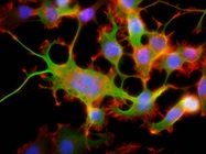Capturing the Infinitesimal: Choosing the Right Camera for Your Microscope