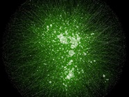 Exosomes: Promising Targets for Liquid Biopsy
