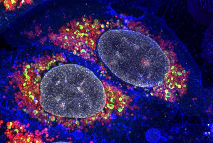 autophagy