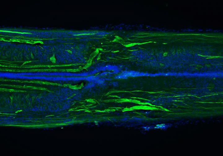 neural regeneration
