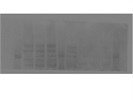 Unclear Anti-CPT1a Antibody for Western Blot