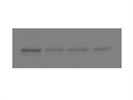 Expression of PDHK1 in Western Blot of Tumor Cells
