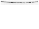 Great Control Antibody for Phospho-AKT Signaling (AKT1)