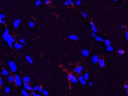 A Great IBA1 Antibody for Microglia