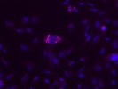 Product Worked Perfectly to Illuminate Autophagy by IF