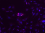 Product Worked Perfectly to Illuminate Autophagy by IF